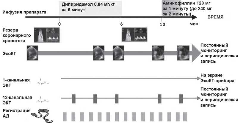 Рис. 2. Схема современного протокола стресс эхокардиографии с дипиридамолом