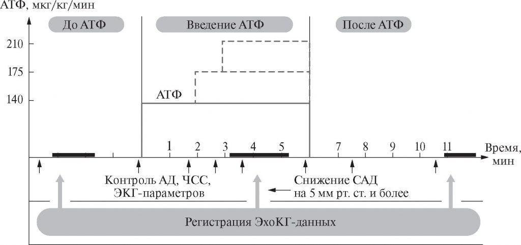 Алгоритм проведения стресс-эхокардиографии с аденозинтрифосфатом