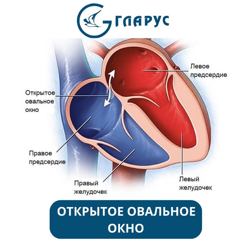 Где находится овальное окно. Незакрытое овальное окно. Марс открытое овальное окно.