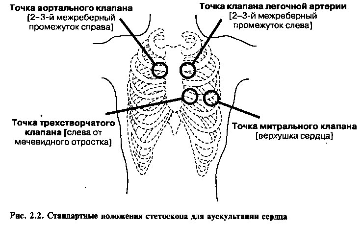 Точки аускультации сердца рисунок