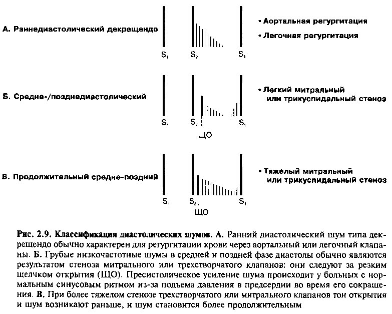 Шум при митральной недостаточности