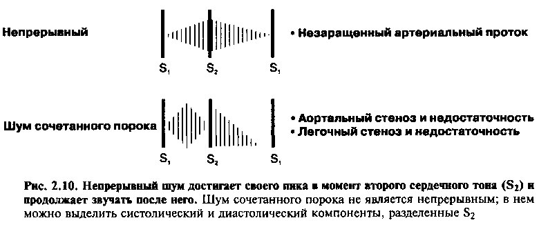 Аускультативная картина митральной недостаточности тест с ответами